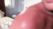 Little Step Sister's Sun Burn Accident - Family Therapy - Alex Adams