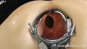 Incredible deep anal view with XO speculum and light in Hotkinkyjo ass