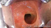 Incredible deep anal view with XO speculum and light in Hotkinkyjo ass