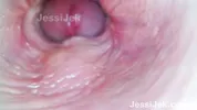 Dream babe got Twice Creampie Endoscope inside showed Extreme Fuck JessiJek